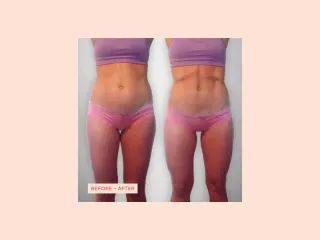 Dieser Anbieter hat keine Bildbeschreibung für dieses Bild hinterlegt